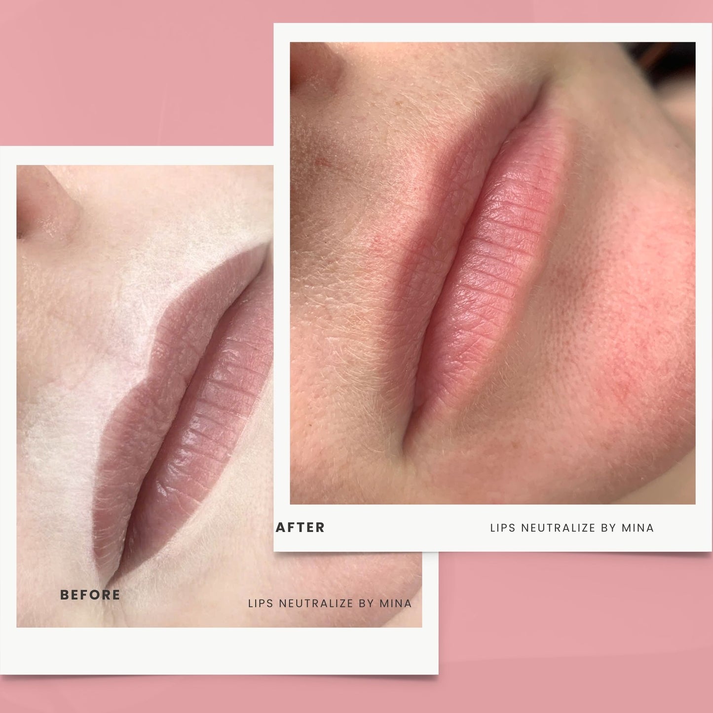Neutralize Lips