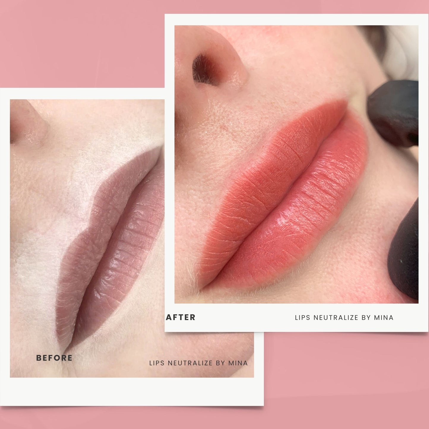 Neutralize Lips